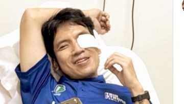 Insiden Tak Terduga: Mata Desta Terluka Akibat Bola Padel Saat Bertanding