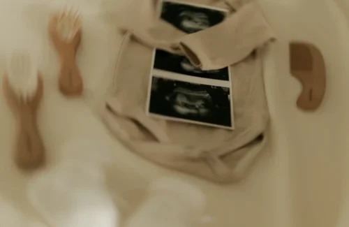Intip Baby Room Calon Anak Amanda Manopo: Desain Minimalis Estetik, Prioritas Kenyamanan dan Keamanan