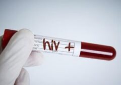 Kemenkes Klarifikasi Data HIV/AIDS Anak di Sidoarjo Pasca Unggahan Viral