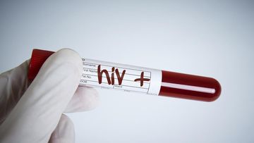 Kemenkes Klarifikasi Data HIV/AIDS Anak di Sidoarjo Pasca Unggahan Viral