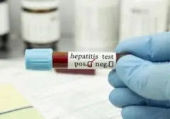 Hepatitis: Ancaman Senyap yang Sulit Dideteksi Dini