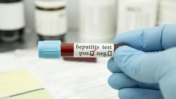 Hepatitis: Ancaman Senyap yang Sulit Dideteksi Dini
