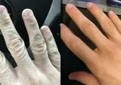 Transformasi Mengejutkan: Deretan Foto Before-After Ungkap Perubahan Radikal