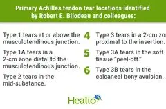 Sistem Klasifikasi MRI Baru Prediksi Titik Cedera Tendon Achilles dengan Akurasi Tinggi