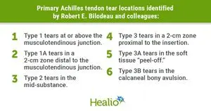 Sistem Klasifikasi MRI Baru Prediksi Titik Cedera Tendon Achilles dengan Akurasi Tinggi