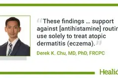 Antihistamin Tambahan Tak Efektif untuk Atopic Dermatitis, Studi Ungkap Hasil Tak Signifikan