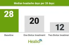 Botox Terbukti Efektif Kurangi Frekuensi dan Dampak Migrain Kronis pada Remaja dan Dewasa Muda