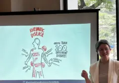 Rheumatoid Arthritis: Kenali Gejala Awal Nyeri Sendi Tangan Saat Bangun Tidur