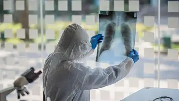 Warga Jakarta Terancam Pneumonia dan Jantung Akibat Polusi Udara yang Memburuk