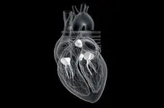 Perbaikan Katup Tricuspid Transkateter Unggul Atasi Regurgitasi Berat