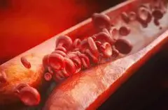 Aterosklerosis Senyap Mengintai Lebih dari Setengah Orang Dewasa Sehat di Eropa