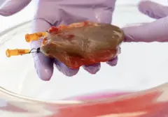 Rekor Baru Xenotransplantasi: Ginjal Babi Bertahan 271 Hari pada Pasien