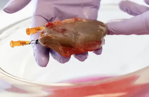 Rekor Baru Xenotransplantasi: Ginjal Babi Bertahan 271 Hari pada Pasien