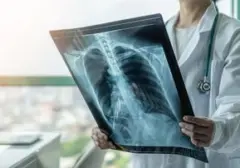Studi Ungkap Mikroplastik dalam Jaringan Paru-Paru Pasien Kanker, Potensi Ancaman Kesehatan