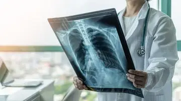 Studi Ungkap Mikroplastik dalam Jaringan Paru-Paru Pasien Kanker, Potensi Ancaman Kesehatan